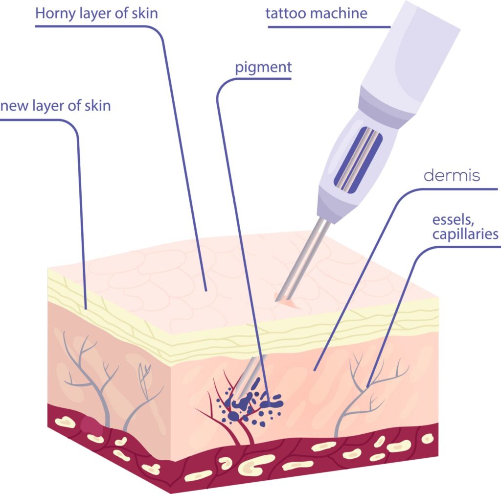 Удаление перманентного макияжа ремувером в Минске